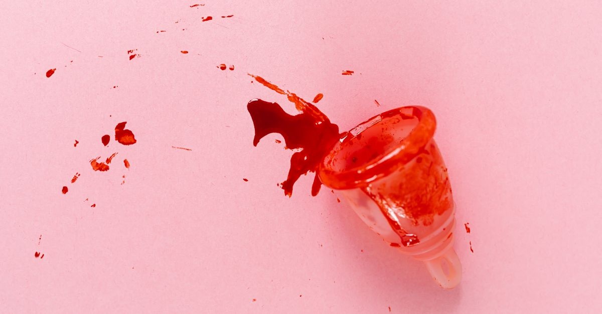 Wenn die Periode klumpig ist: Was Blutgerinnsel bedeuten – und wann du zum Arzt solltest